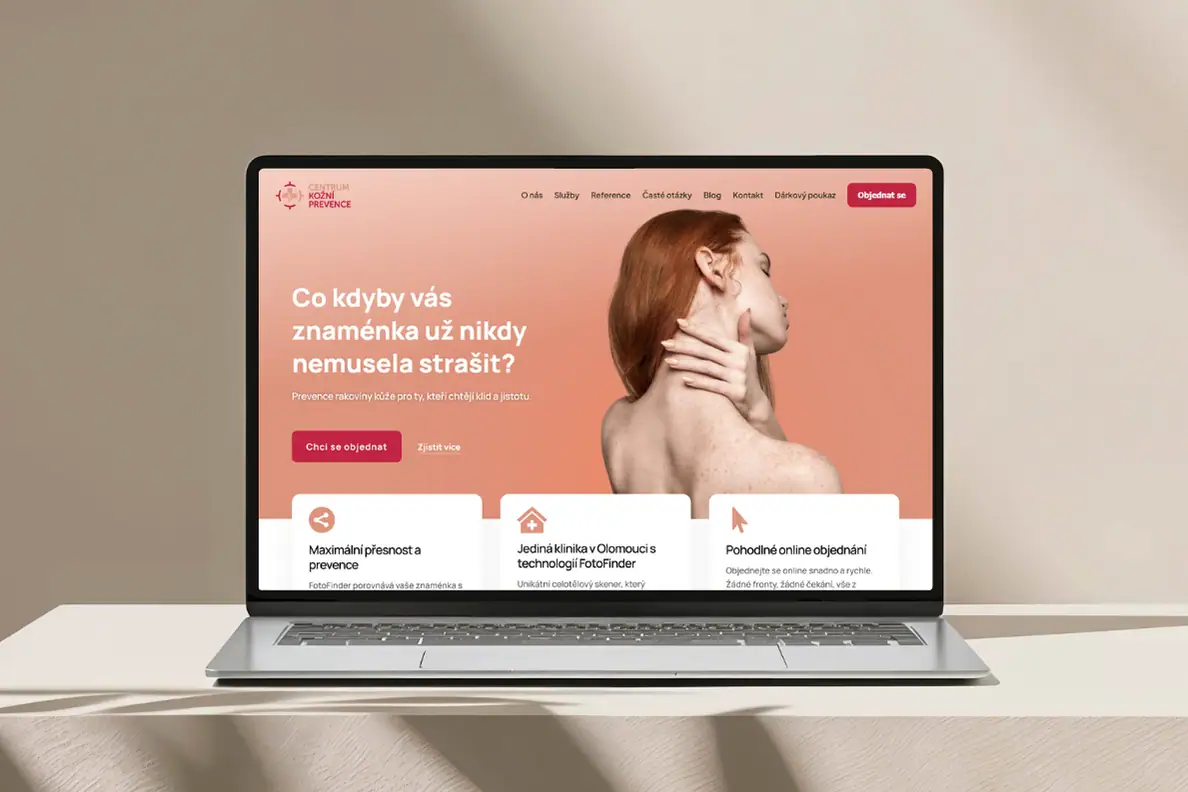 Web pro centrum kožní prevence